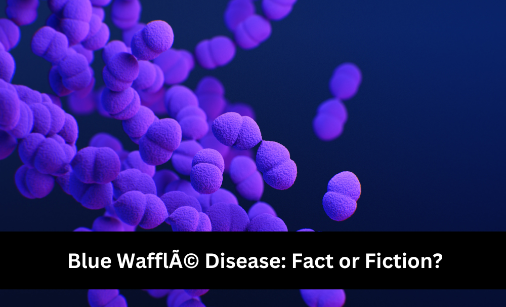 Blue WafflÃ© Disease Fact or Fiction