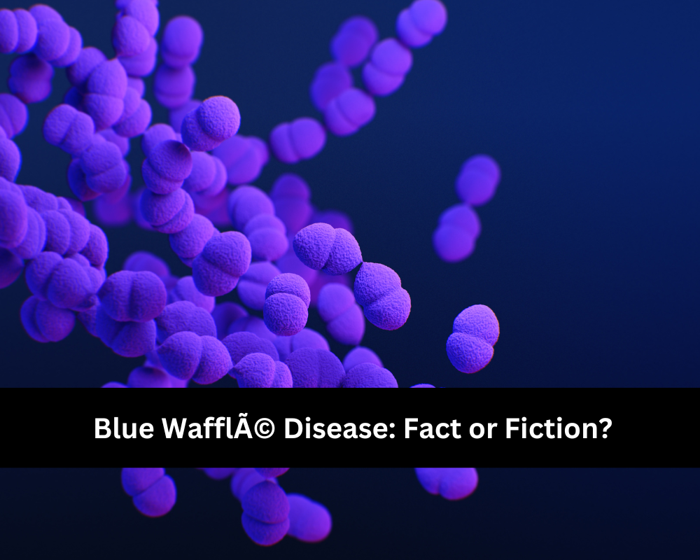 Blue WafflÃ© Disease Fact or Fiction