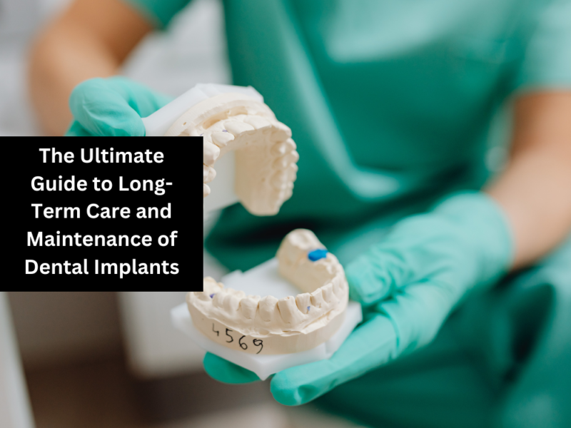 The Ultimate Guide to Long-Term Care and Maintenance of Dental Implants