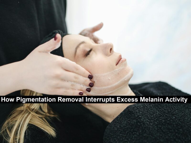 Pigmentation Removal