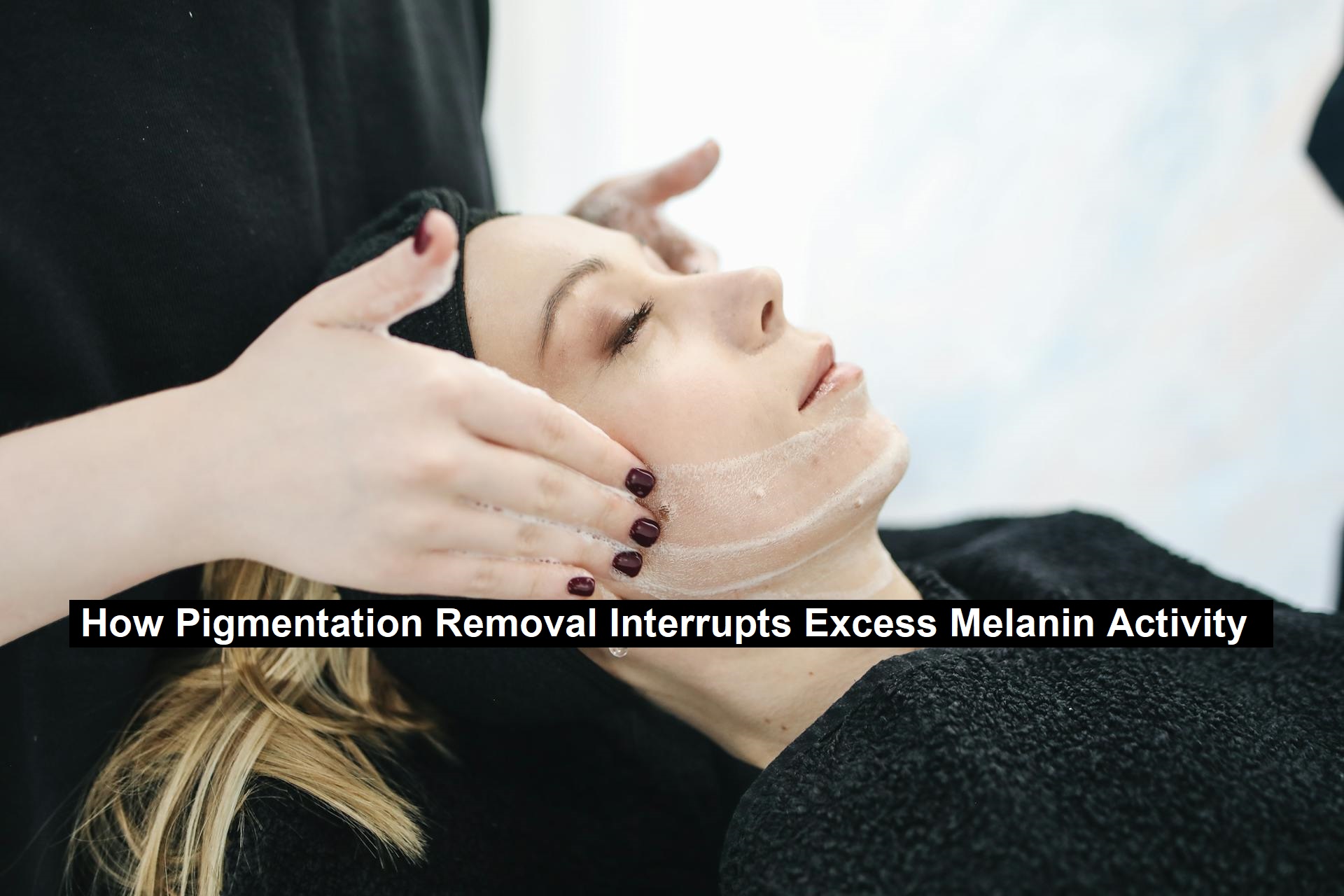 Pigmentation Removal