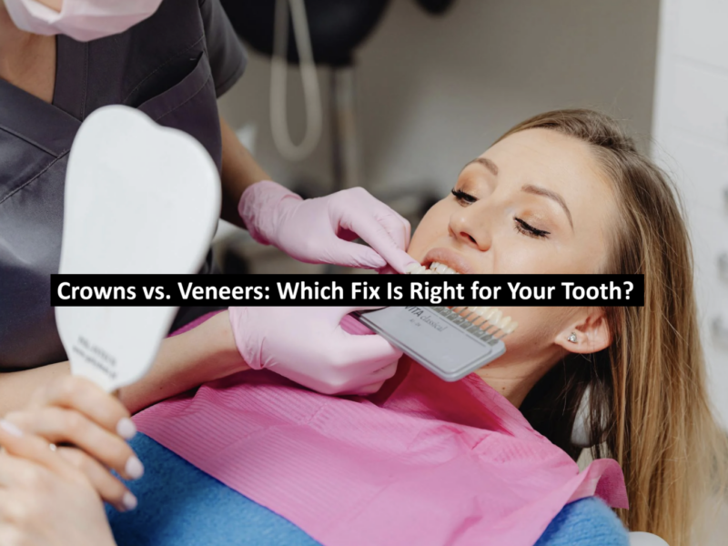 Crowns vs. Veneers